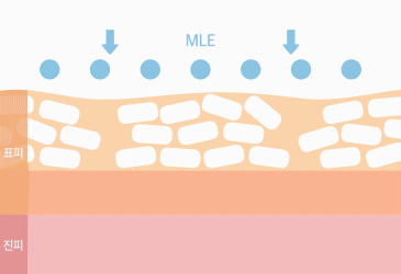 독자 개발 피부장벽 기술 MLE(엠엘이)
