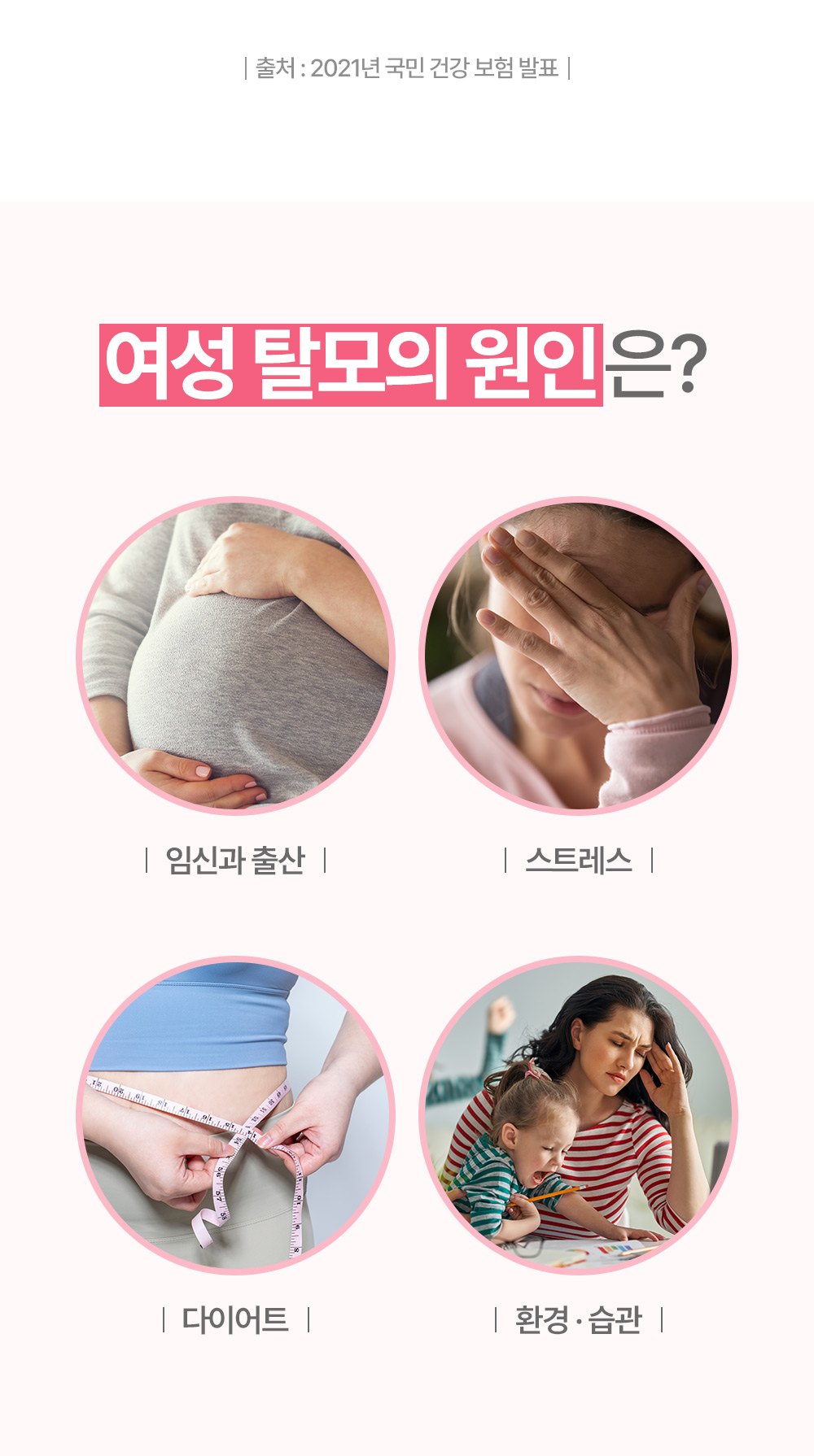 Causes of women's hair loss include pregnancy, childbirth, stress, diet, environment, and habits