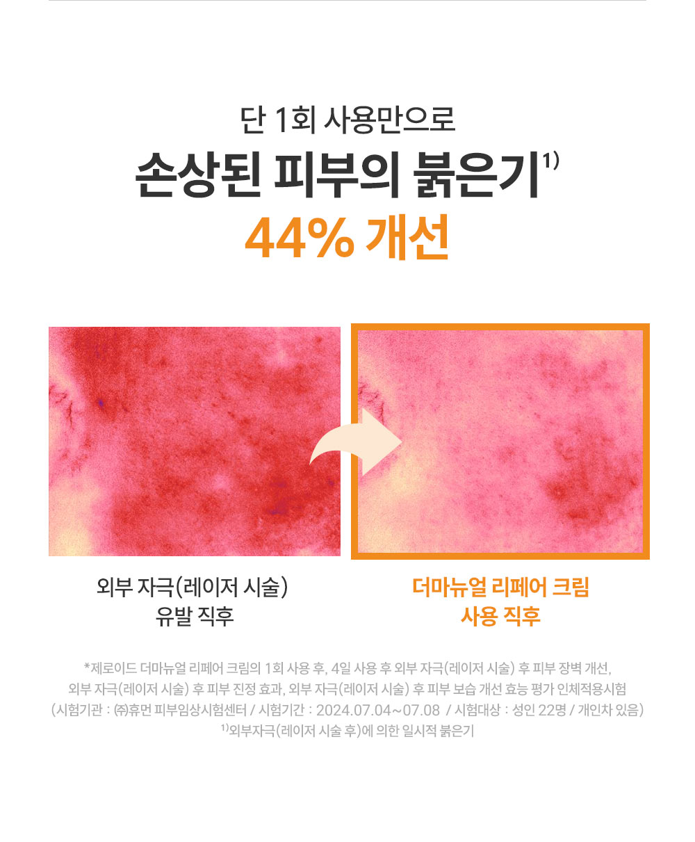 단 1회 사용만으로 손상된 피부의 붉은기 44% 개선