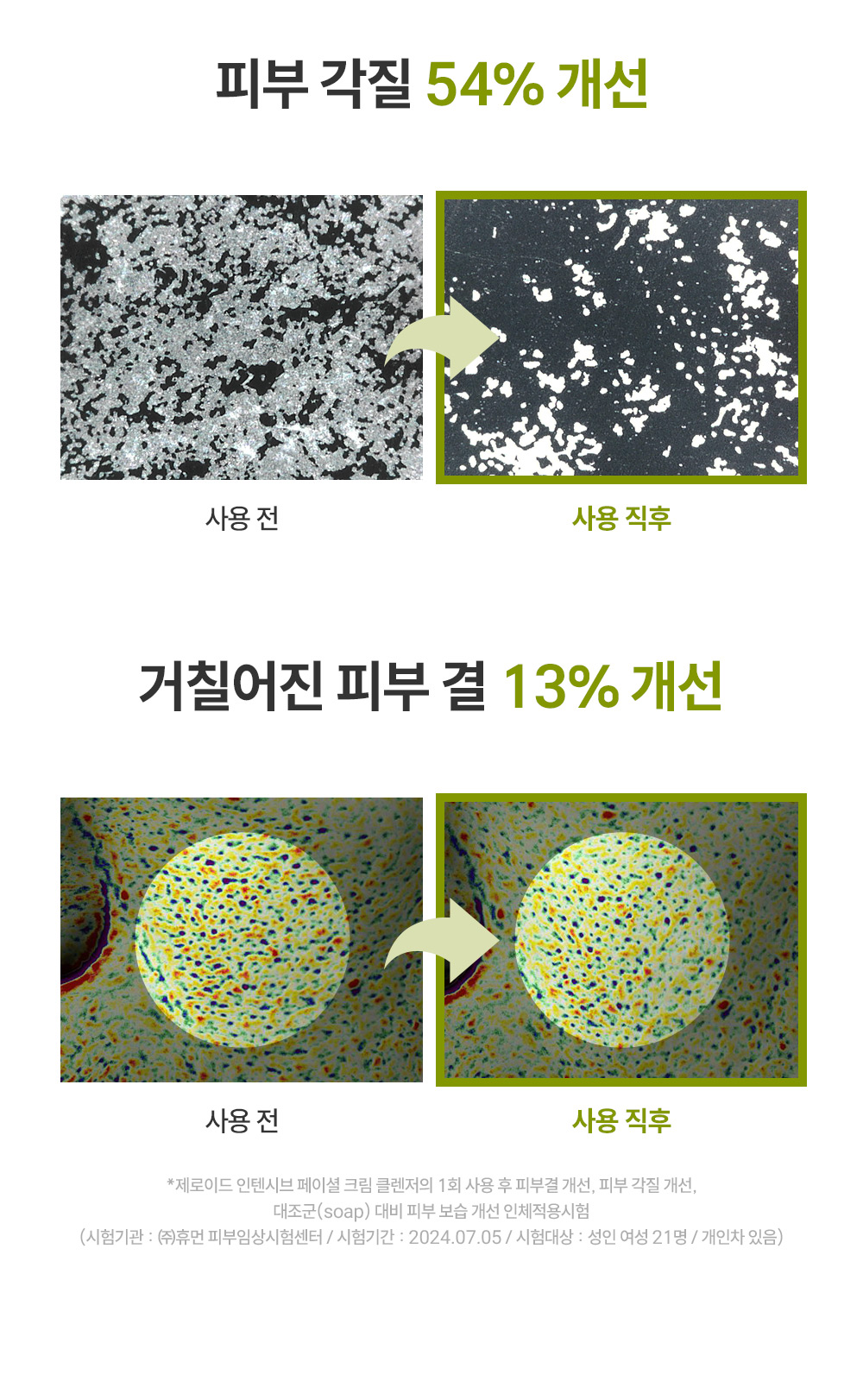 피부 각질 54% 개선 거칠어진 피부결 13% 개선