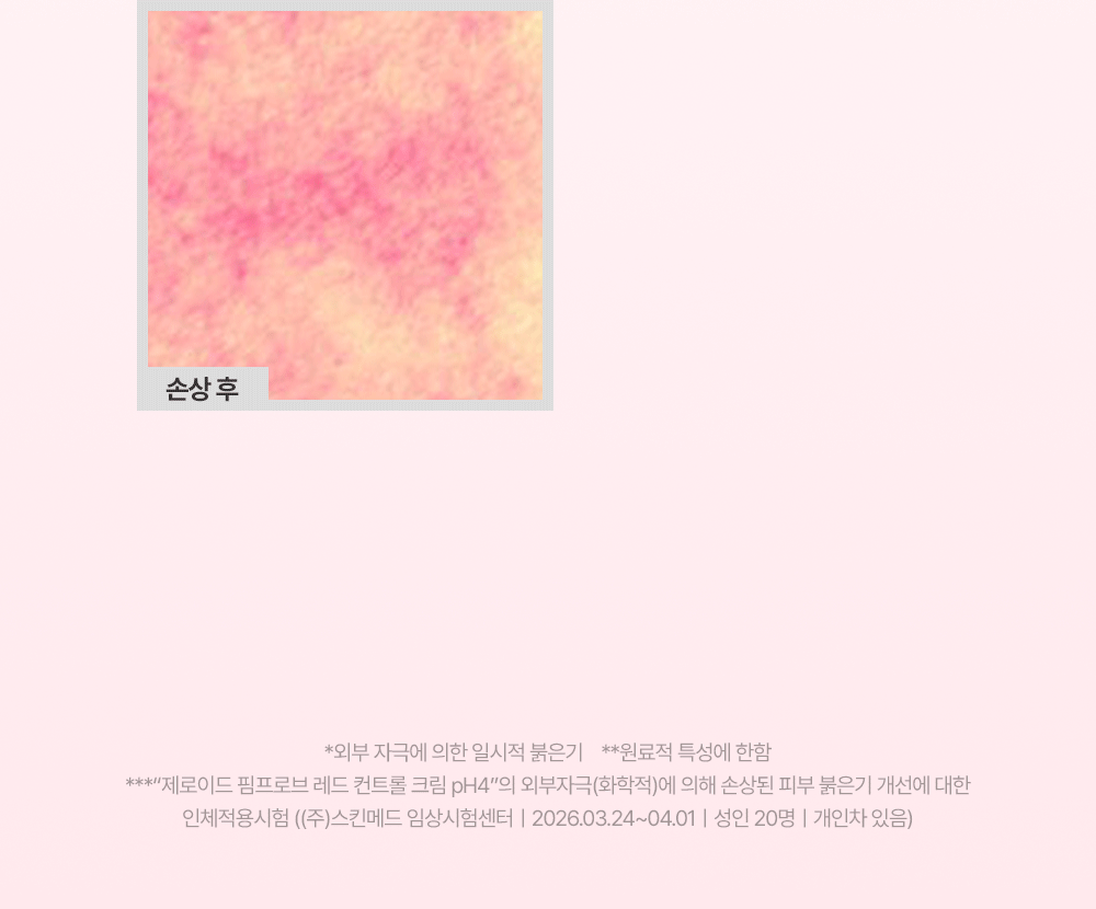 1주 사용 후 붉은 기 진정 89.36퍼센트