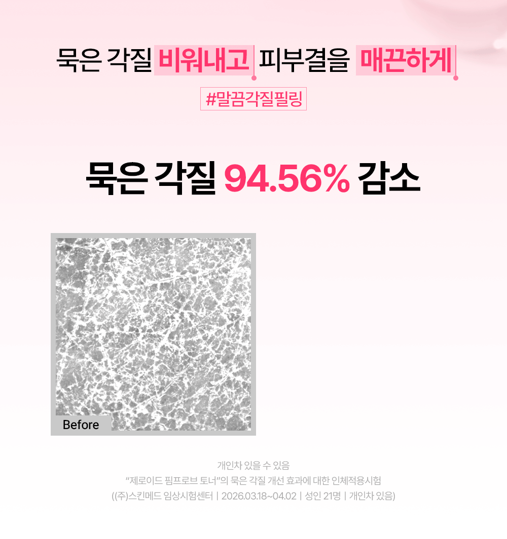 묵은 각질 94.56퍼센트 감소