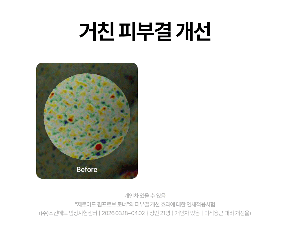 거친 피부결 개선