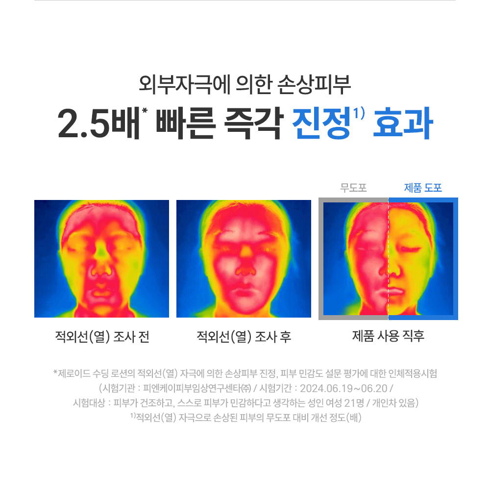 외부자극에 의한 손상피부 2.5배 빠른 즉각 진정 효과