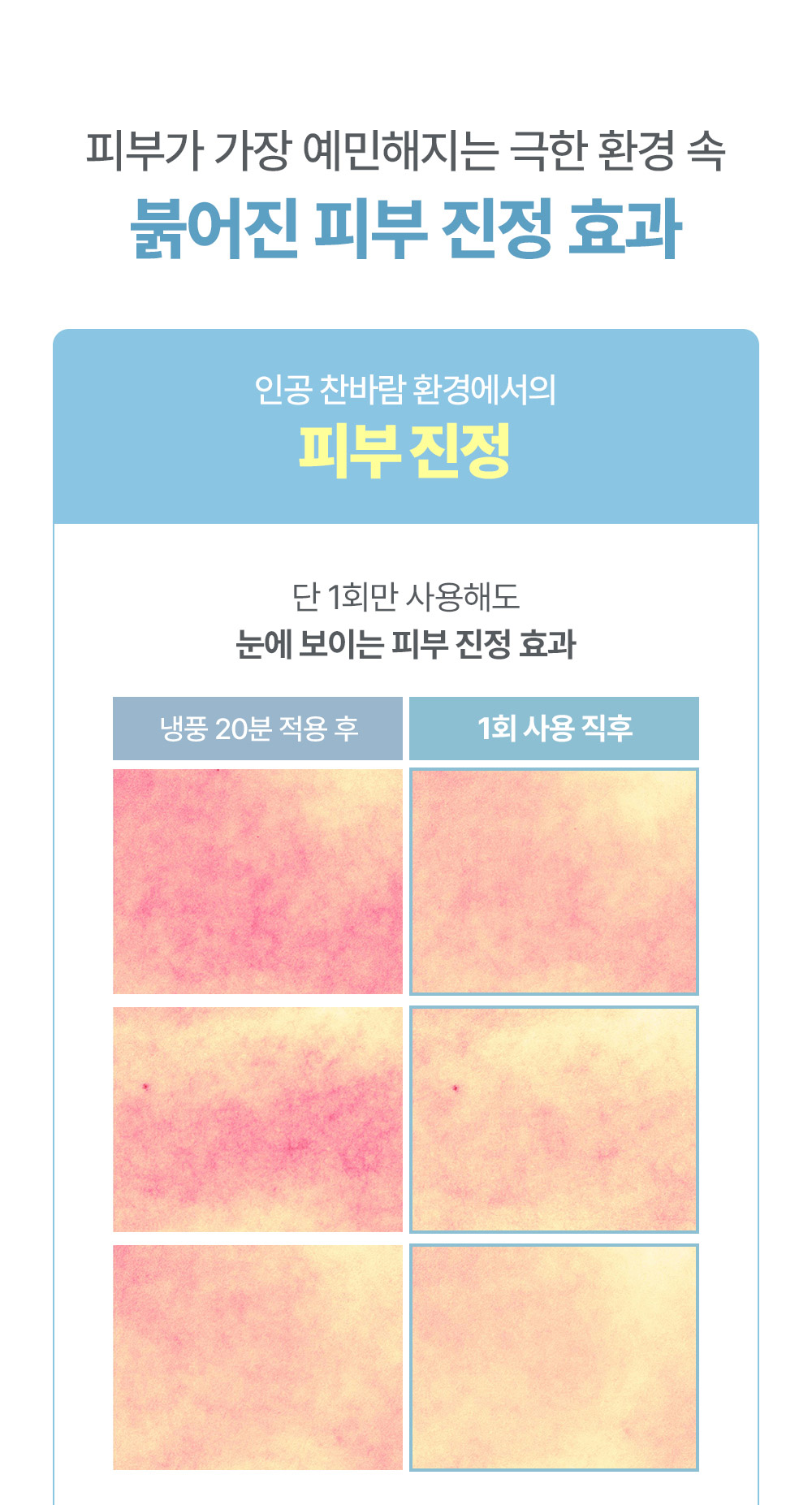 피부가 가장 예민해지는 극한 환경 속 붉어진 피부 즉각 진정 효과