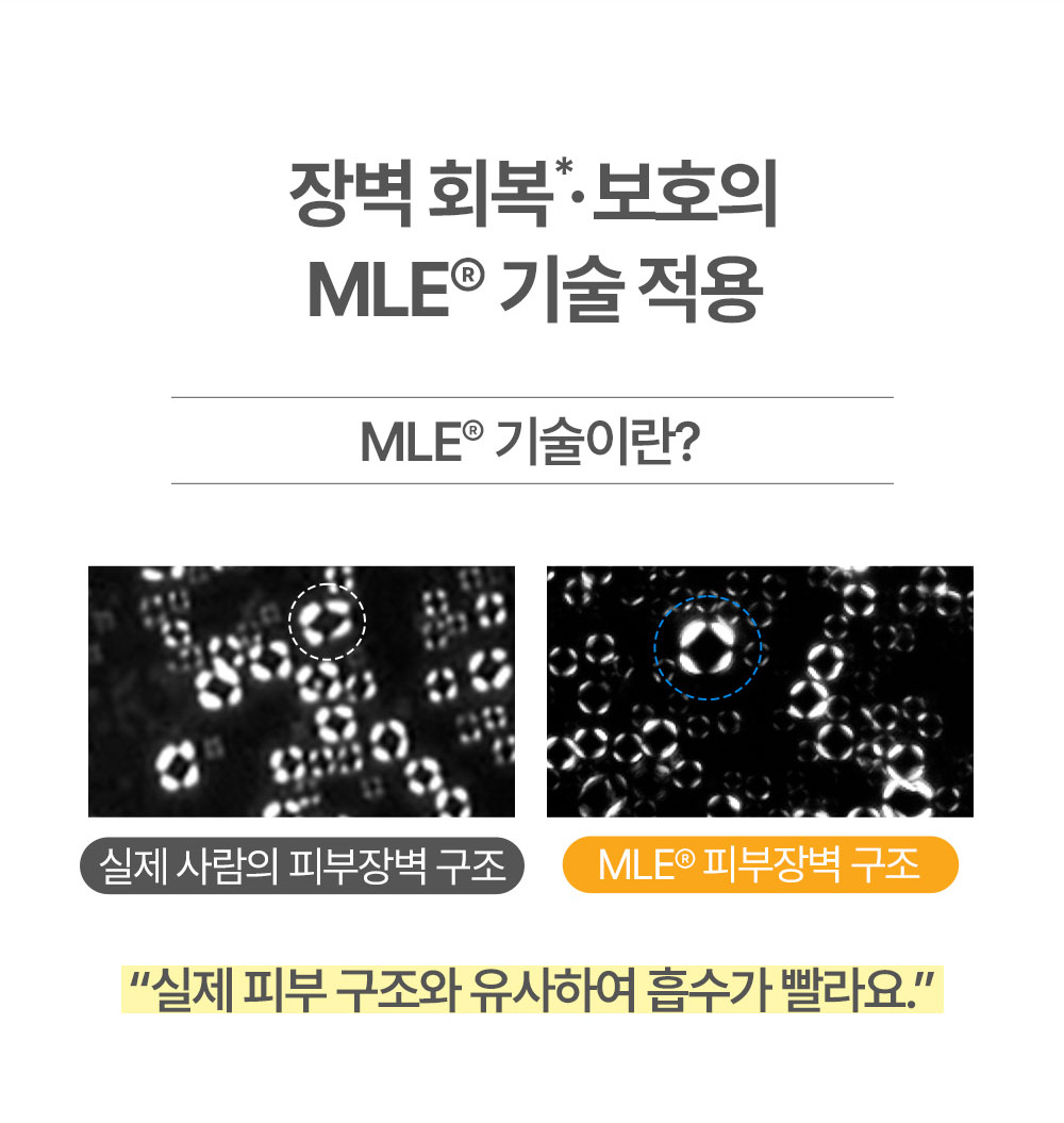 장벽 회복 *· 보호의 MLE® 기술 적용