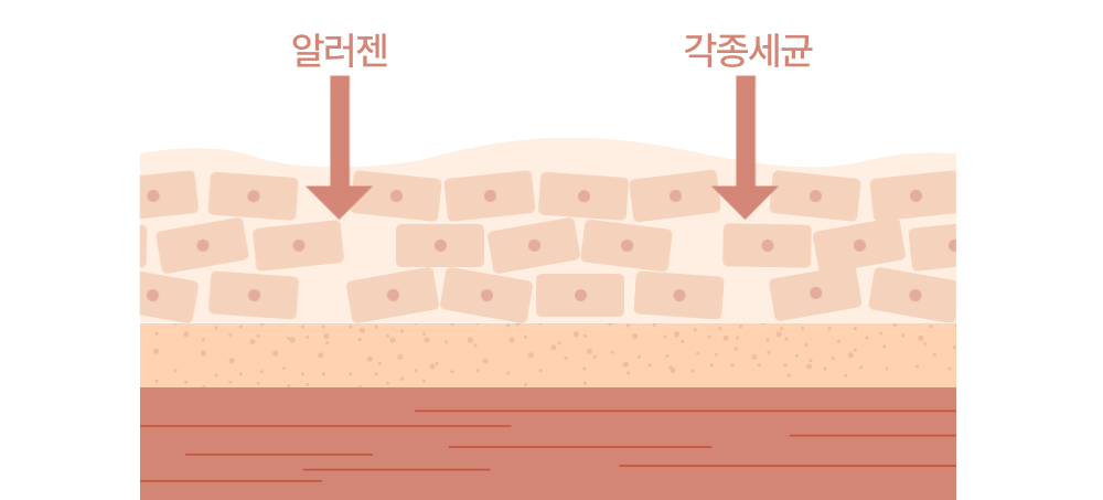 mle 피부장벽 강화로 알러젠 각종세균으로부터 보호하는 이미지