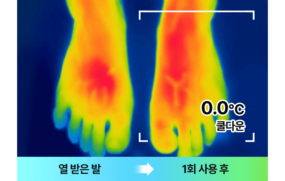 열 받은 발에 데오프레쉬 풋샴푸를 사용직후 온도를 비교한 영상