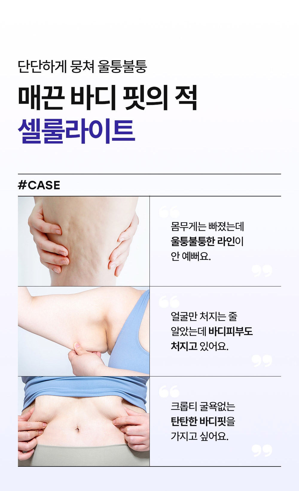 단단하게 뭉쳐 울퉁불퉁 매끈 바디 핏의 적 셀룰라이트 #CASE 몸무게는 빠졌는데 울퉁불퉁한 라인이 안 예뻐요. 얼굴만 처지는 줄 알았는데 바디피부도 처지고 있어요. 크롭티 굴욕없는 탄탄한 바디핏을 가지고 싶어요.