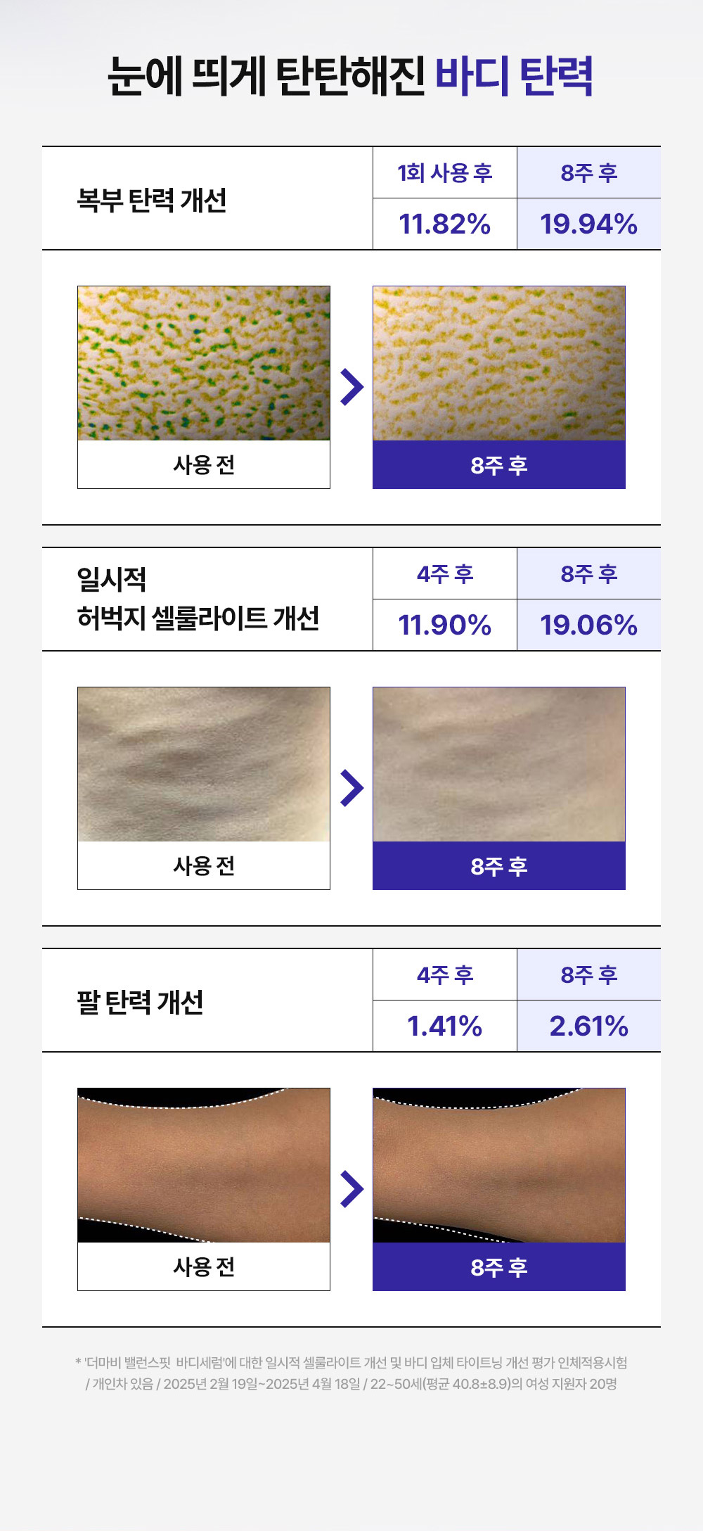 눈에 띄게 탄탄해진 바디 1.탄력 복부 탄력 개선 1회 사용 후 11.82% 개선 8주 후 19.94% 개선, 2.일시적 허벅지 셀룰라이트 개선 4주 후 11.90% 개선 8주 후 19.06% 개선, 3.팔 탄력 개선 4주 후 1.41% 개선 8주 후 2.61% 개선