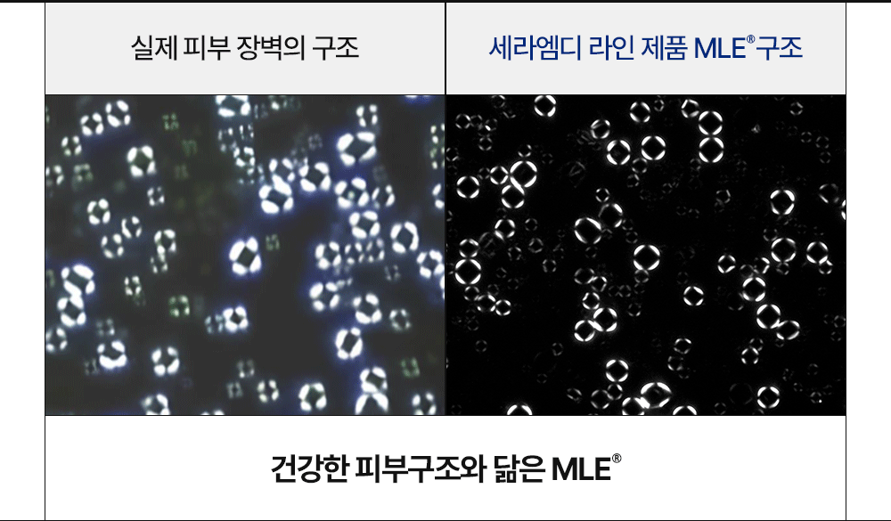 실제 피부 장벽의 구조와 세라엠디 라인 제품 MLE® 구조 비교 gif 이미지