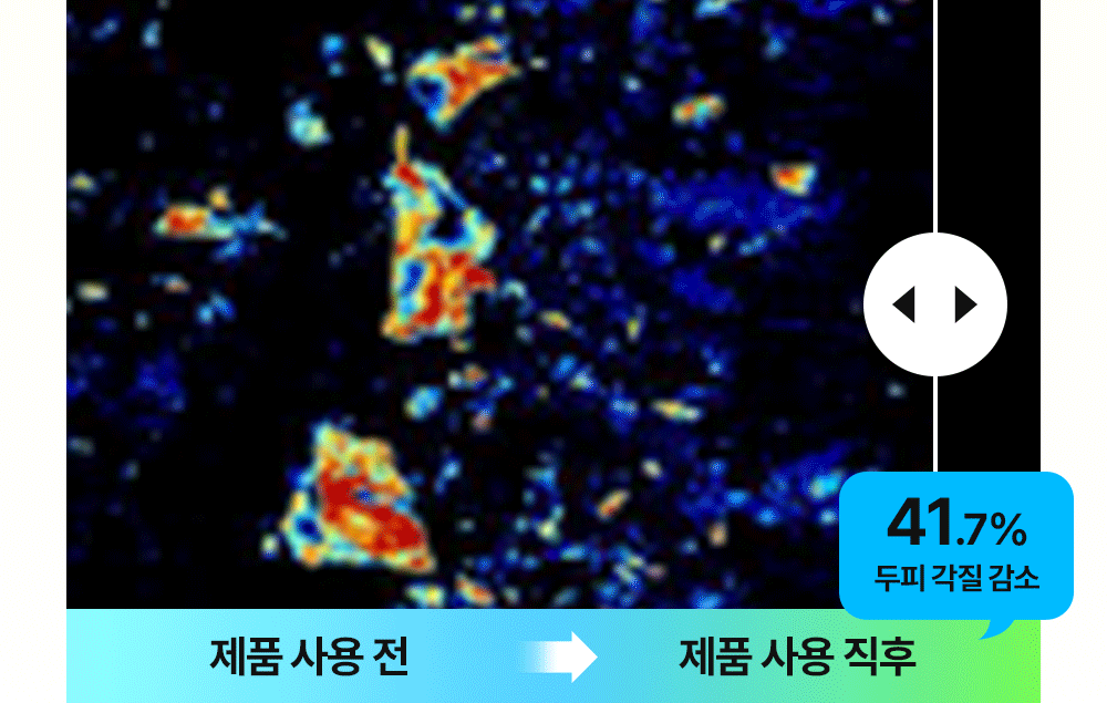 제품 사용 전 직후 41.7% 두피 각질 감소