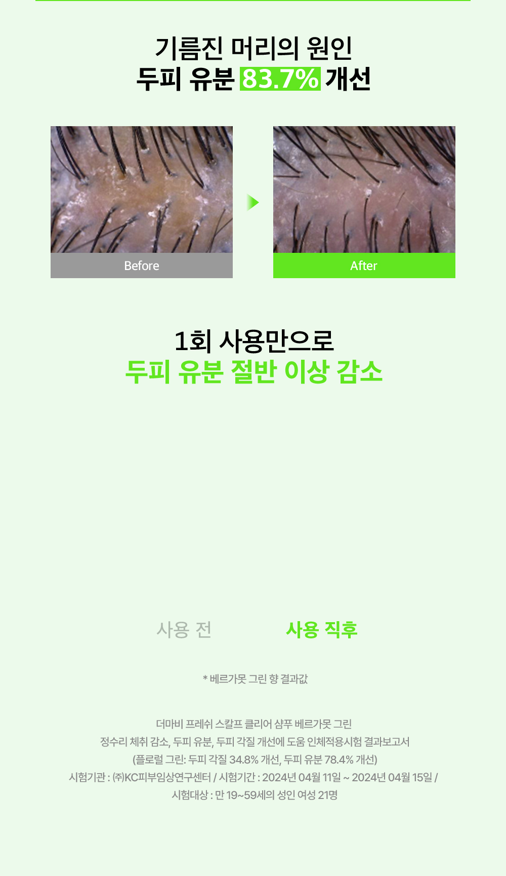Improvement of 83.7% in scalp oil, the cause of greasy hair