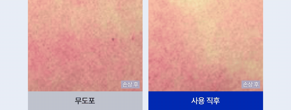 손상 후 무도포와 사용 직후 비교