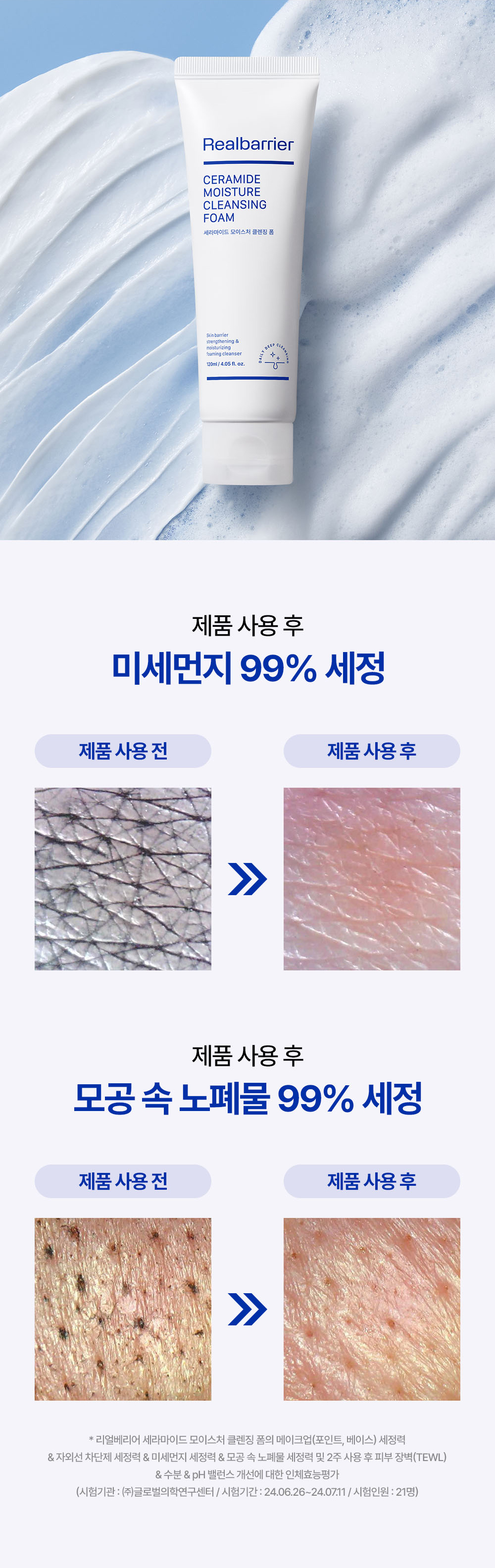세라마이드 모이스처 클렌징 폼 제품 사용 후 미세먼지 99% 세정, 모공 속 노폐물 99% 세정