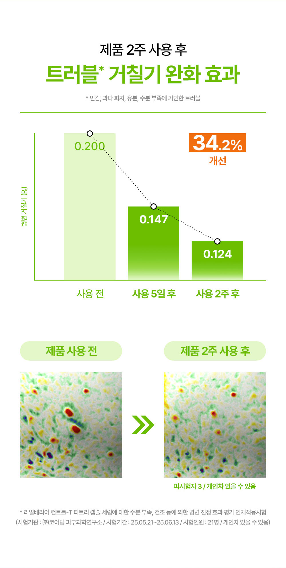 제품 2주 사용 후 트러블 거칠기 완화 효과