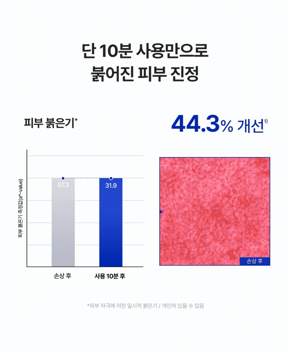 단 10분 사용으로 붉어진 피부 진정 44.3%25 개선