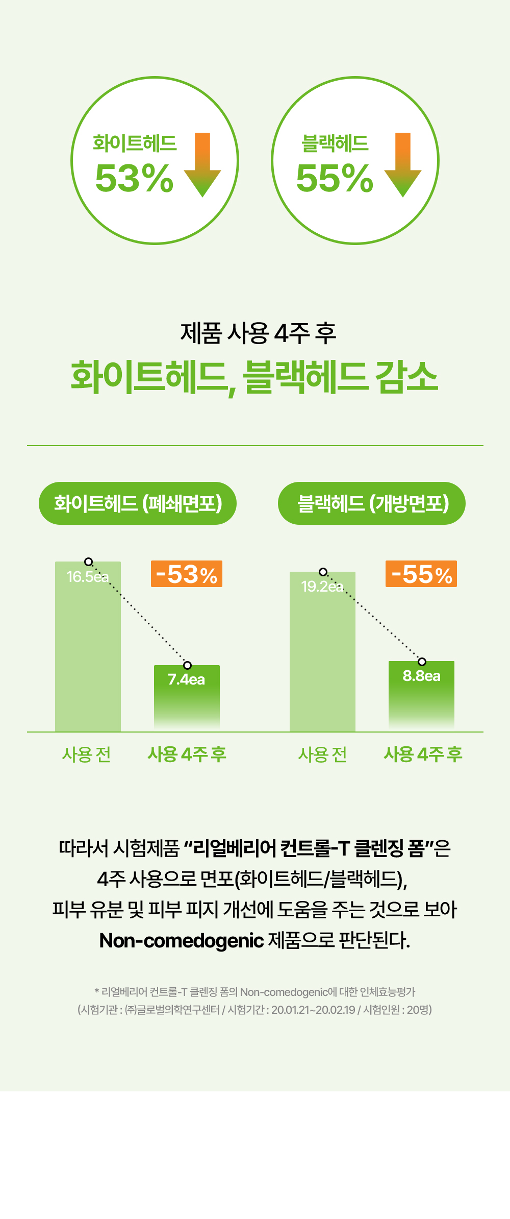 제품 사용 4주 후 화이트헤드, 블랙헤드 감소