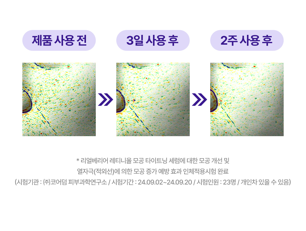 제품 사용 전 > 3일 사용 후 > 2주 사용 후