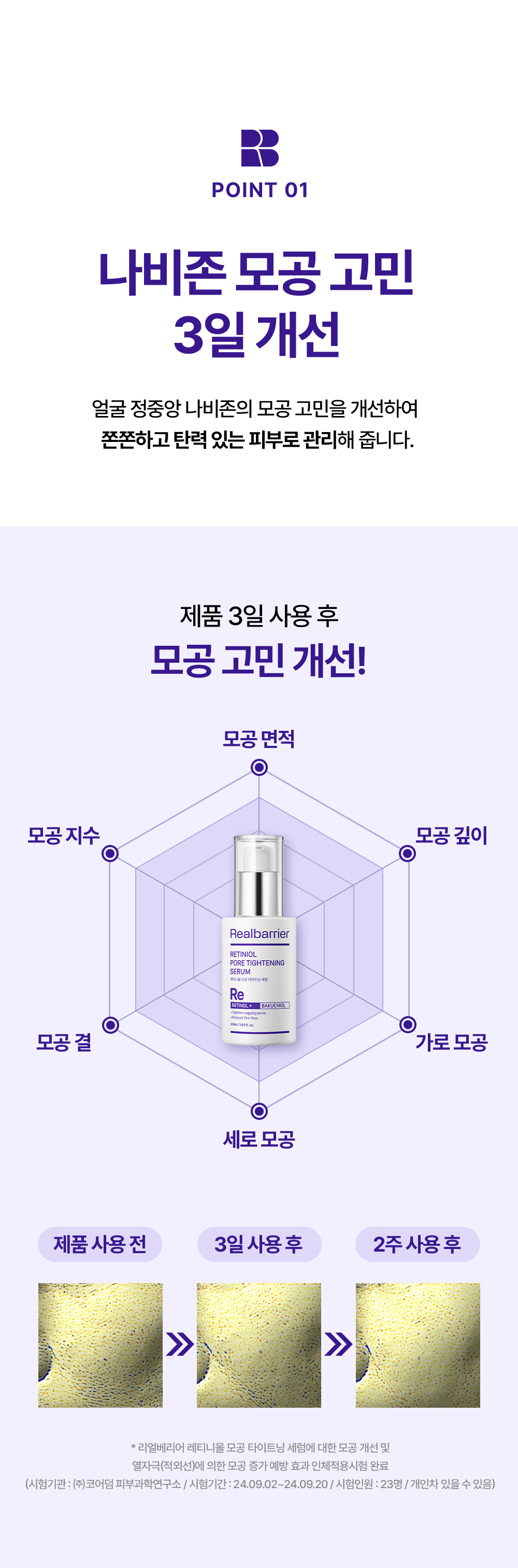 POINT 01. 나비존 모공 고민 3일 개선